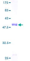 Human PDLIM4 / RIL Protein (Recombinant GST)