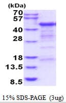 Human CD4 Protein (Recombinant His)