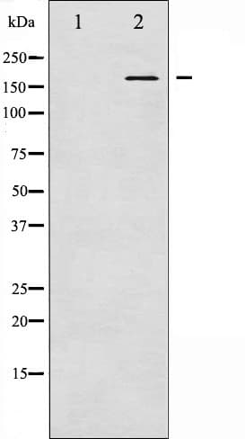 GRIN2B / NMDAR2B / NR2B Antibody (phospho-Tyr1474)