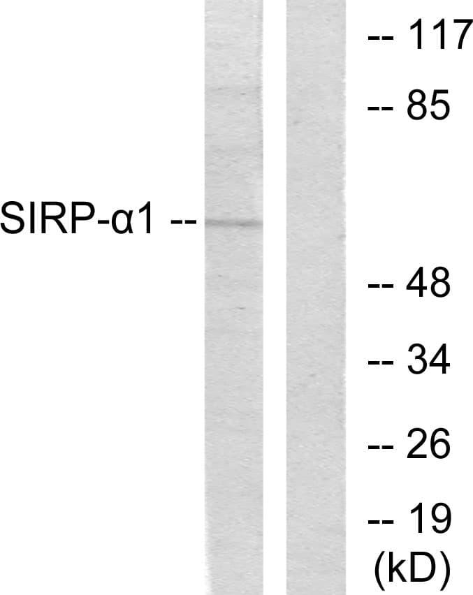 IHC-plus™ SIRPA / CD172a Antibody (aa451-500)