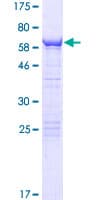 Human CWC27 Protein (Recombinant GST)