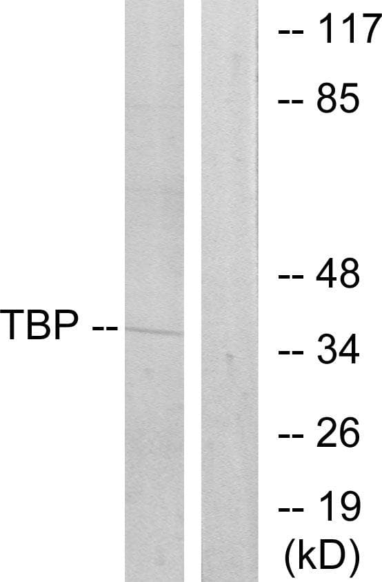 TBP / GTF2D Antibody