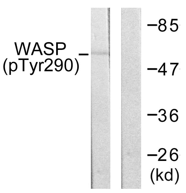 Polyclonal Rabbit anti-Human WAS / WASP Antibody (phospho-Tyr290, IHC, WB)