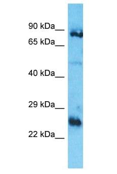 Polyclonal Rabbit anti-Human PIK3CB / PI3K Beta Antibody (aa35-84, WB)