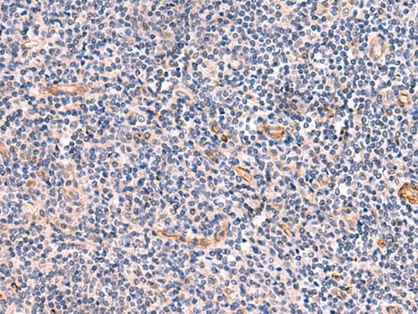 IA-6 / INSM2 Antibody