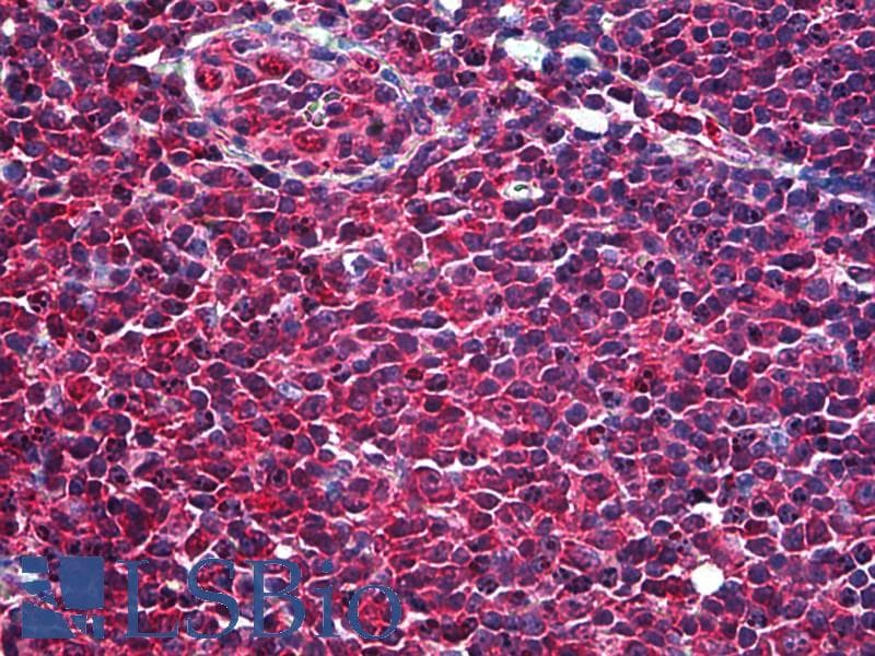IHC-plus™ Polyclonal Rabbit anti-Human SYK Antibody (aa313-339, IHC, WB)