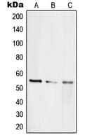Polyclonal Rabbit anti-Human TERF2IP / RAP1 Antibody (Internal, WB)