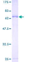 Human ANO10 / TMEM16K Protein (Recombinant GST)