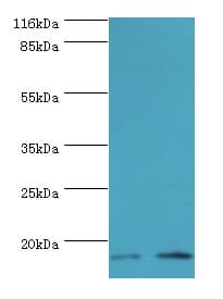 LSM4 Antibody (aa1-139, FITC)