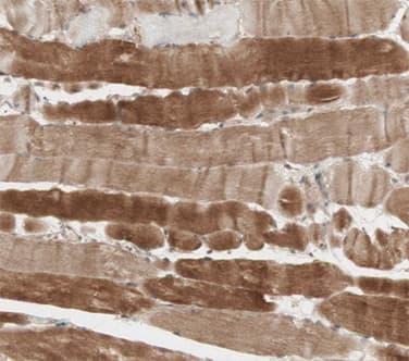 DES / Desmin Antibody