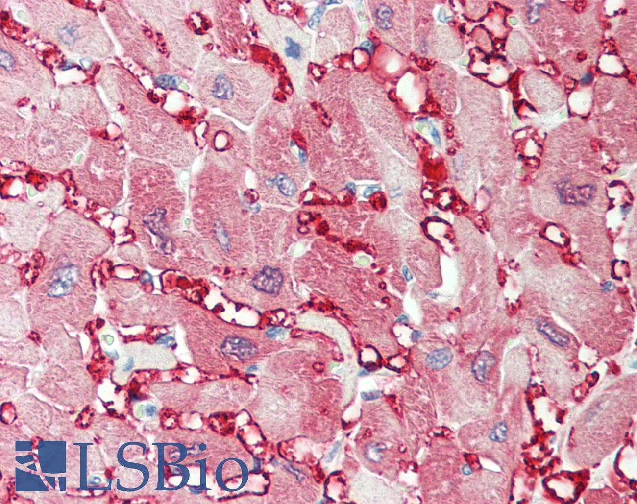 IHC-plus™ CKM / Creatine Kinase MM Antibody (aa5-18)