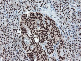 TPRKB Antibody (clone OTI3H3)