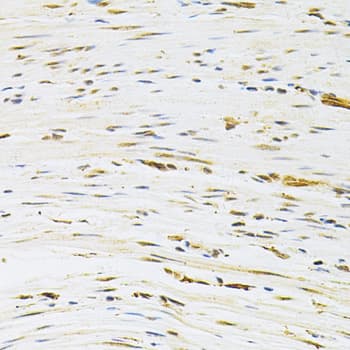 MDM2 Antibody
