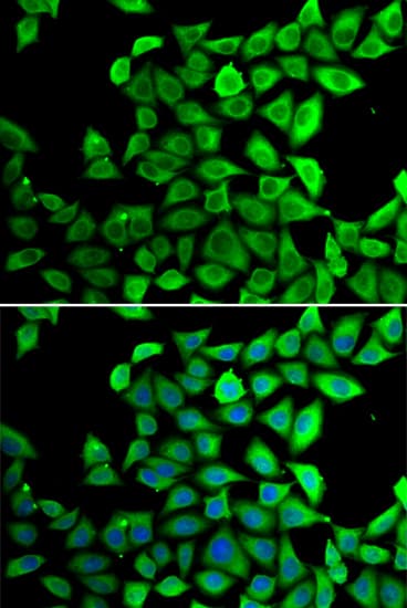 PPID / Cyclophilin D Antibody