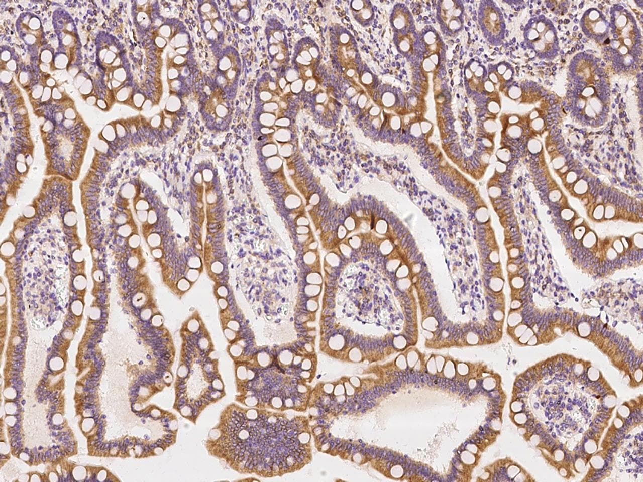 Polyclonal Rabbit anti-Human USE1 / p31 Antibody (IHC, IF, WB)