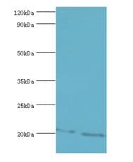 Polyclonal Rabbit anti-Human GLO1 / Glyoxalase I Antibody (aa1-184, IHC, WB)