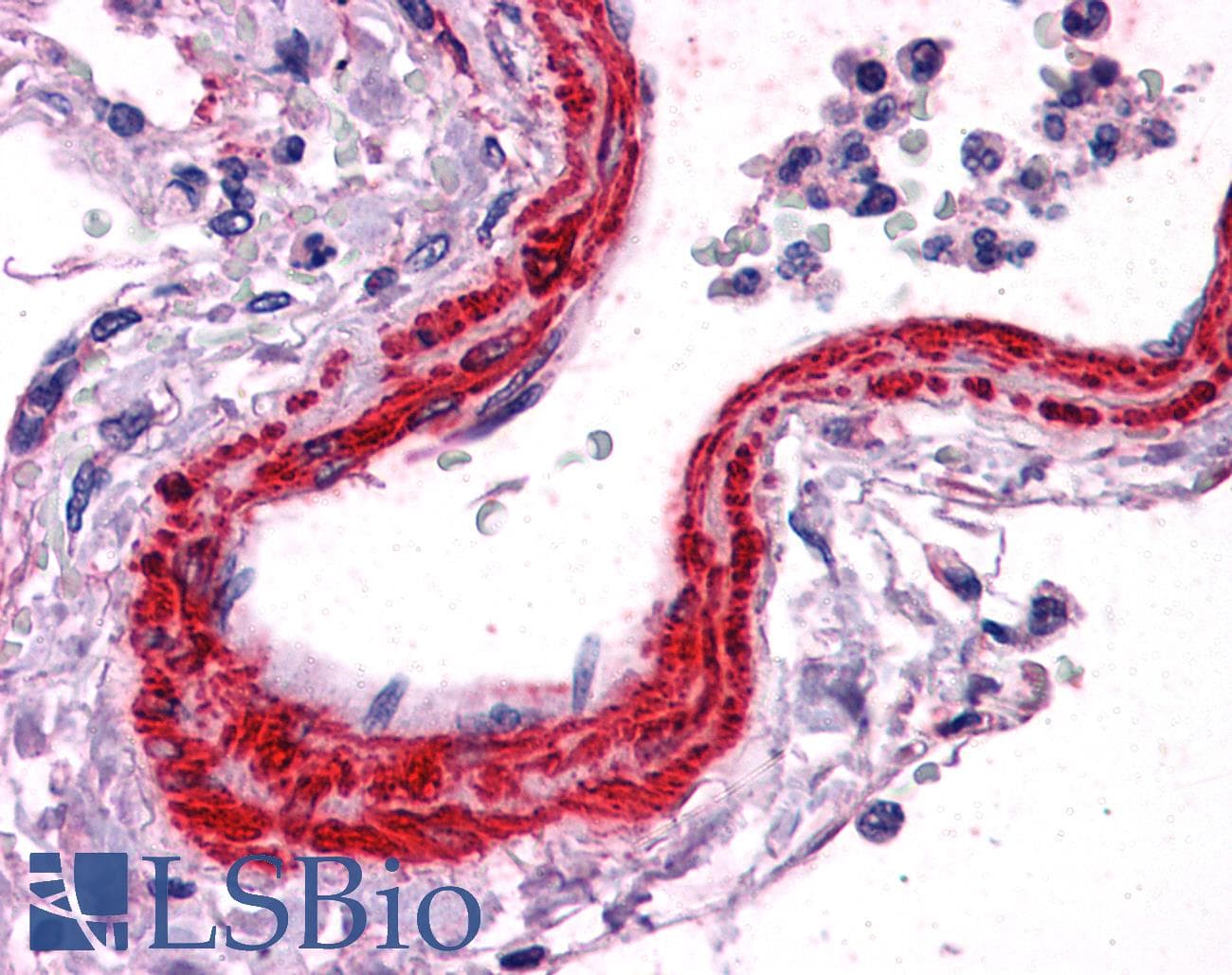PathPlus™ ACTA2 / Smooth Muscle Actin Antibody (aa1-50)