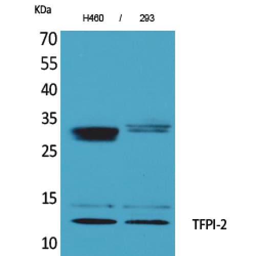 TFPI2 Antibody (C-terminal)