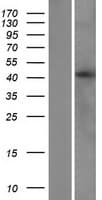 LIAS / LIP1 Protein (Over-Expression Lysate Myc-DDK (Flag))