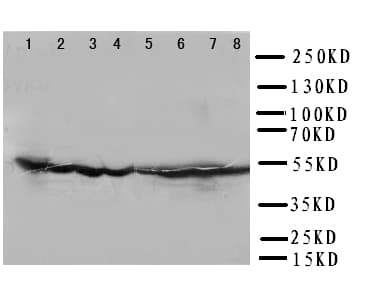 DLD / Diaphorase / E3 Antibody (aa492-509)