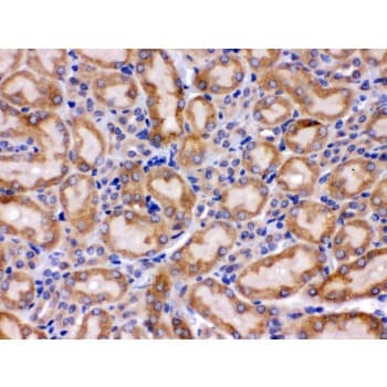 HSPA9 / Mortalin / GRP75 Antibody (aa646-679)
