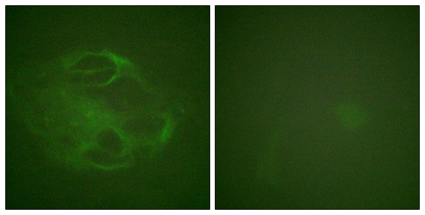HRS / HGS Antibody (aa301-350)