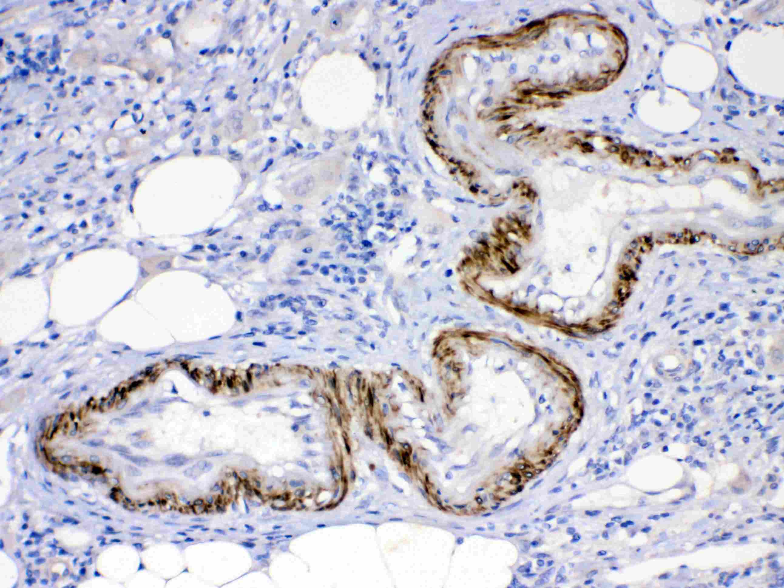 ACVR2 / ACVR2A Antibody