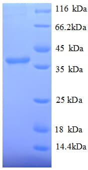Human SRP14 Protein (Recombinant GST)