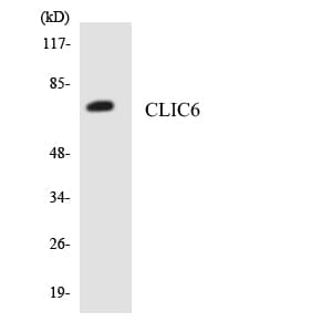 CLIC6 Antibody (aa395-444)
