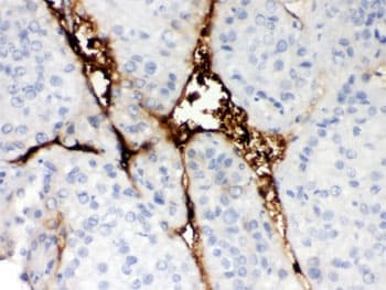 Polyclonal Rabbit anti-Human CA1 / Carbonic Anhydrase I Antibody (IHC, WB)