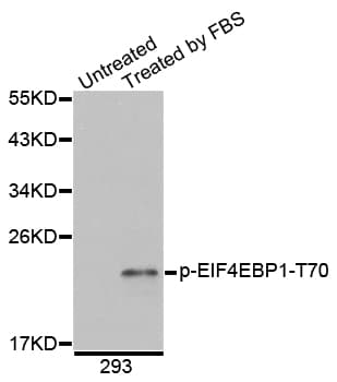 EIF4EBP1 / 4EBP1 Antibody (phospho-Thr69)