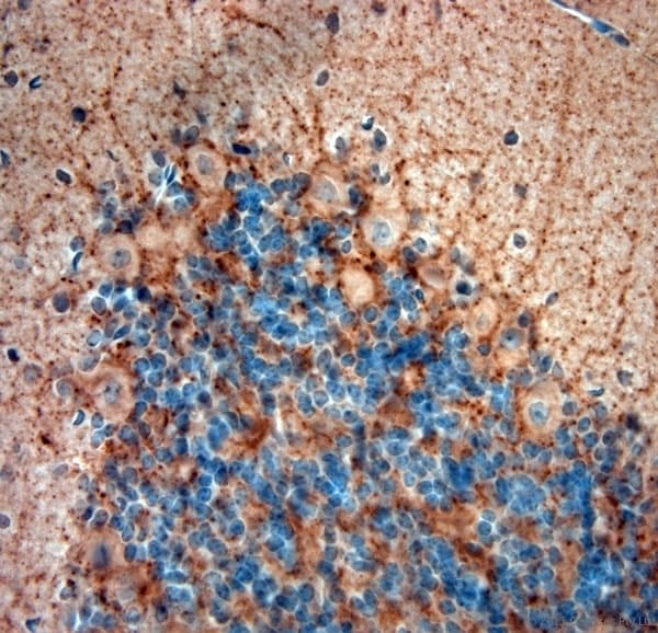 GAD 65+67 Antibody (aa530-600)