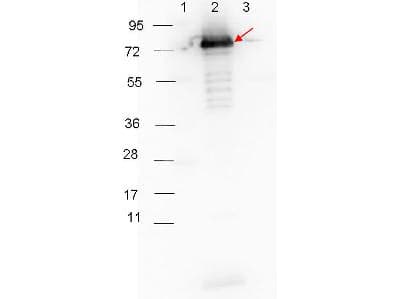 Surface Lipoprotein p27 Antibody (Liquid)