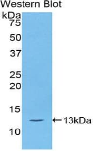 AIF1 / IBA1 Antibody (aa35-130)