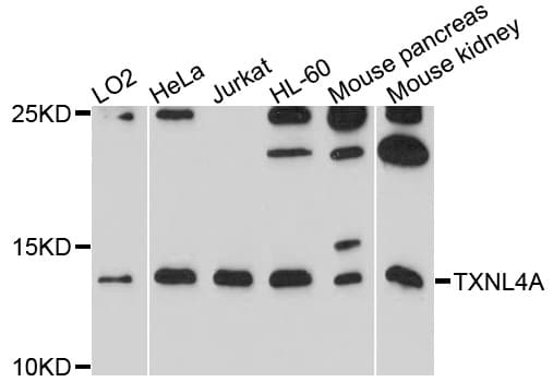 Polyclonal Rabbit anti-Human TXNL4A Antibody (WB)