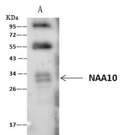 NAA10 / ARD1A Antibody (Preservative Free)