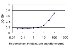 GCLM Antibody (clone 2B8)