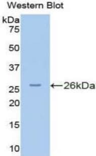PKN2 Antibody (aa282-487)