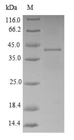 Shigella flexneri Adenylate Kinase Protein (Recombinant 10His-SUMO, N-terminus + Myc, C-terminus)