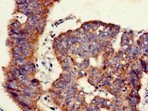 GLB1 / Beta-Galactosidase Antibody