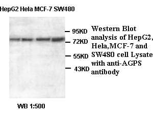 IHC-plus™ Polyclonal Rabbit anti-Human AGPS Antibody (IHC, WB)