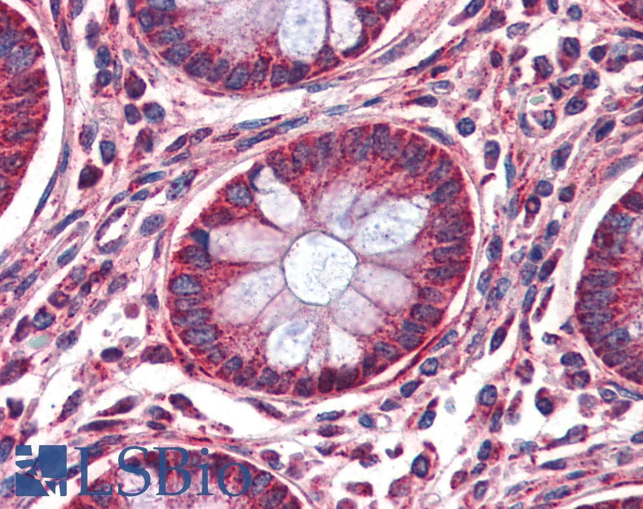 IHC-plus™ MMP14 Antibody (aa160-173)