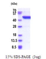 Human SERPINB8 Protein (Recombinant His)