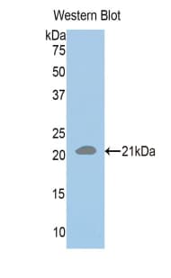 RAD50 Antibody (aa631-793)