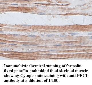 ECI2 / PECI Antibody