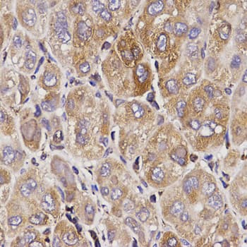 IHC-plus™ Polyclonal Rabbit anti-Human TAP2 Antibody (IHC, IF, WB)