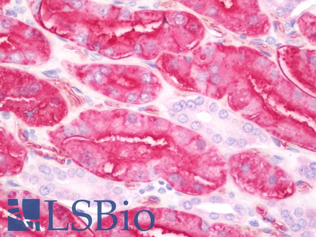 IHC-plus™ Monoclonal Mouse anti-Human AQP1 / Aquaporin 1 Antibody (clone 1F3, IHC, WB)