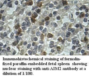 AIM2 Antibody (aa93-342)