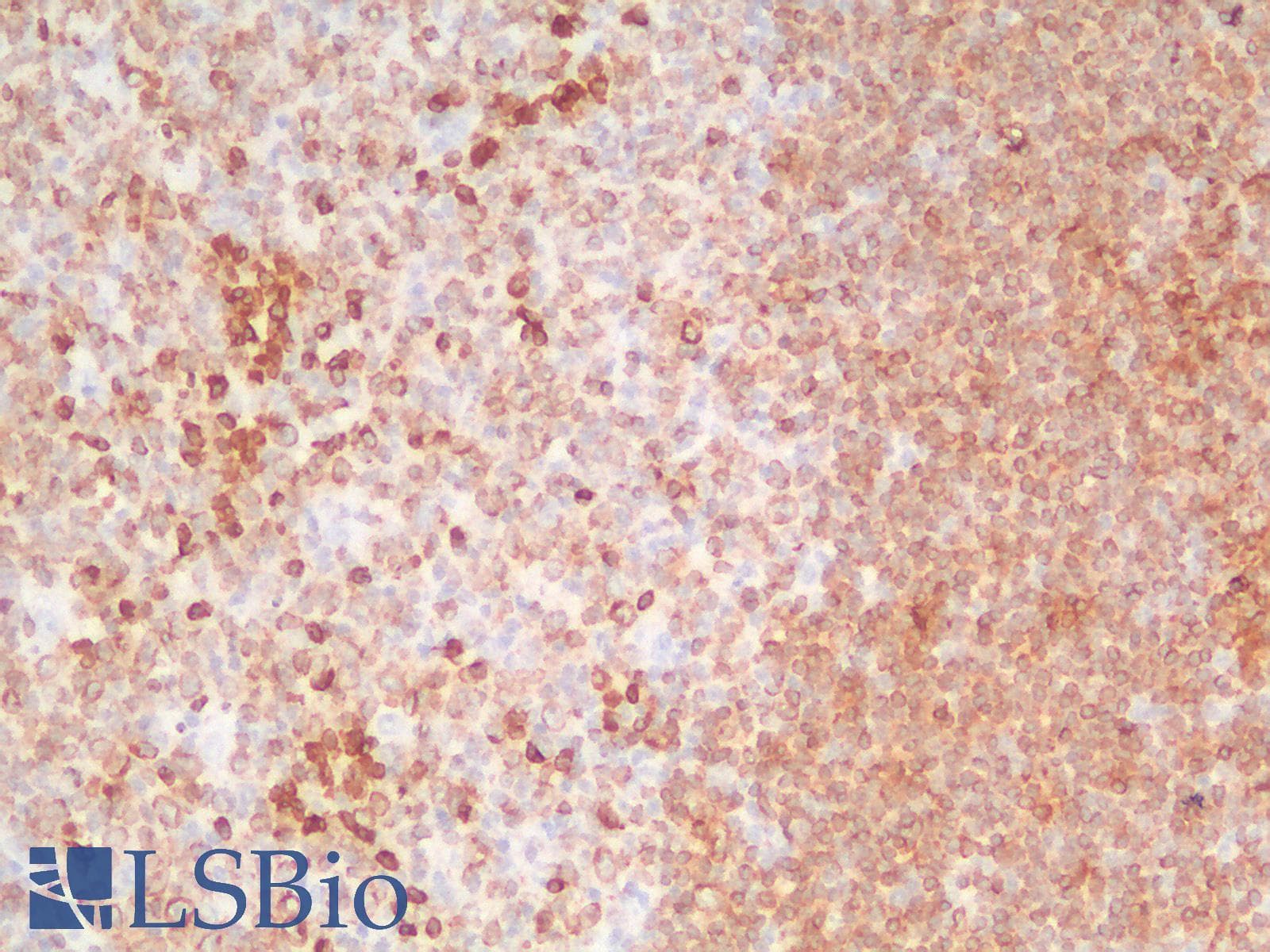 PathPlus™ CD79A / CD79 Alpha Antibody (aa202-216, clone IGA/1688R)