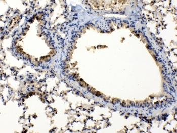 PPL / Periplakin Antibody